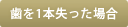 歯を1本失った場合